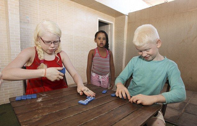 Бразильская мамаша родила тройню альбиносов