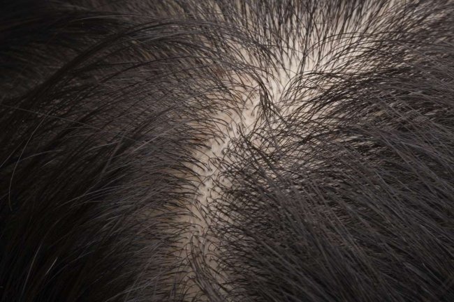 30 интересных фактов о волосах, которые вы не знали