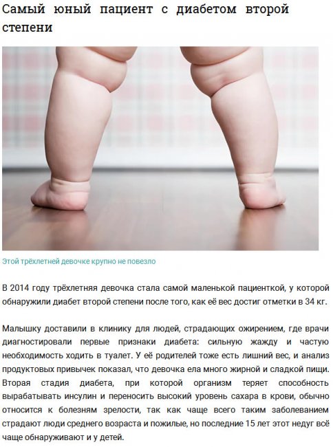 Самые толстые дети в мире
