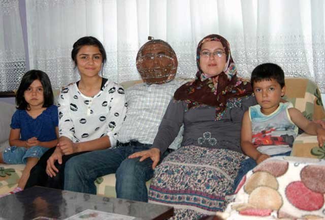 Житель Турции закрыл голову в клетке, чтобы избавиться от никотиновой зависимости