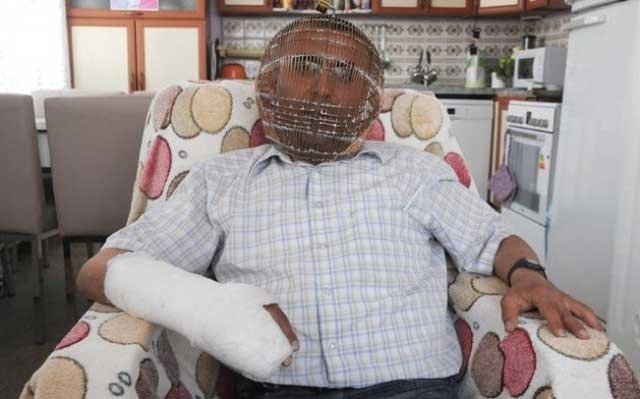 Житель Турции закрыл голову в клетке, чтобы избавиться от никотиновой зависимости