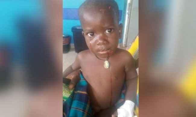 Вторя жизнь двухлетнего мальчика в Уганде