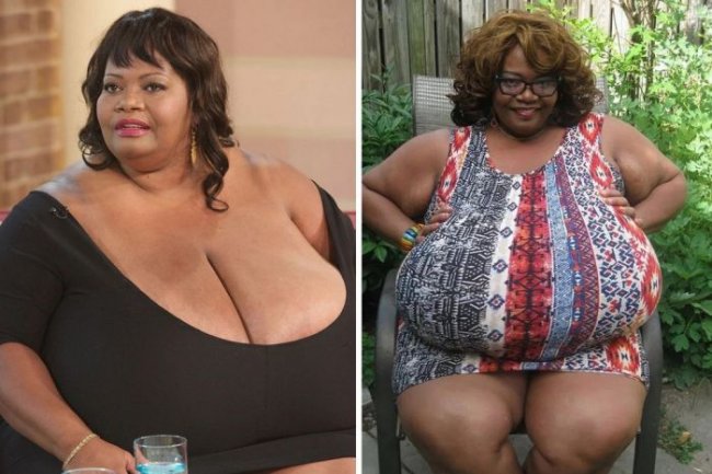 Женщина разбогатела и прославилась благодаря 60-килограммовой груди
